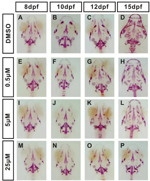 斑马鱼幼鱼在不同浓度的泼尼松龙治疗会引起骨质疏松症表型
