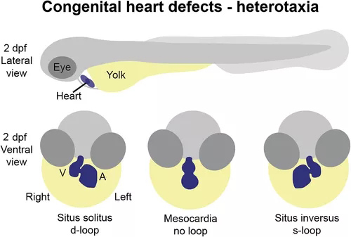 先天性心脏缺陷的斑马鱼模型