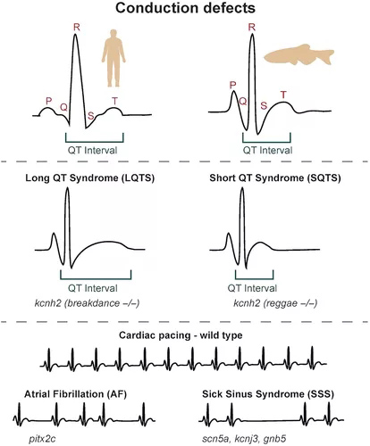 心脏传导缺陷的斑马鱼模型