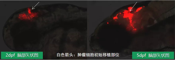 斑马鱼异种移植瘤模型
