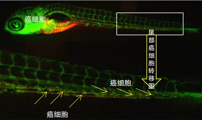 斑马鱼异种移植瘤模型